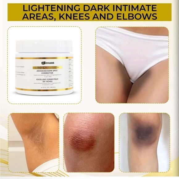 NIB CCHANS ADVANCED DARK SPOTS CORRECTOR FACE/BODY MINIMIZE SCARS/SKIN DAMAGE - Picture 6 of 14